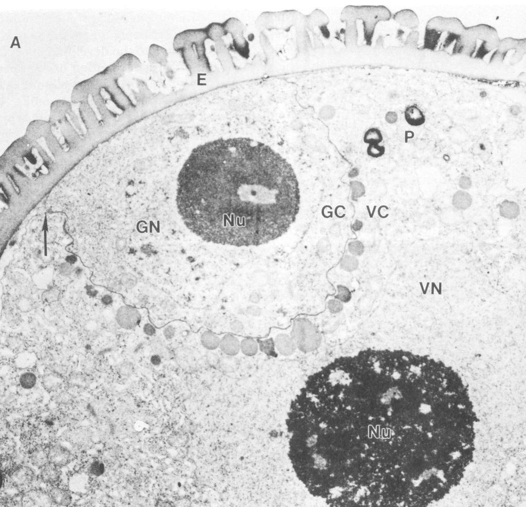 TEM pylového zrna pryšce (Euphorbia) (Cresti et al.