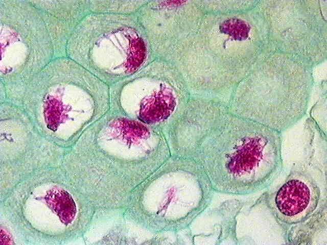 Mikrosporocyty v rané