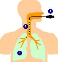 BRONCHOSKOPIE Endoskop 1) se zavede nosem nebo ústy přes
