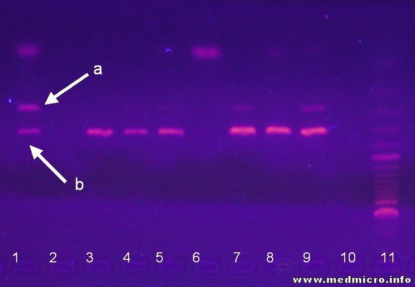 Elektroforéza produktů PCR reakce při průkazu B. burgdorferi a) Úsek DNA B.