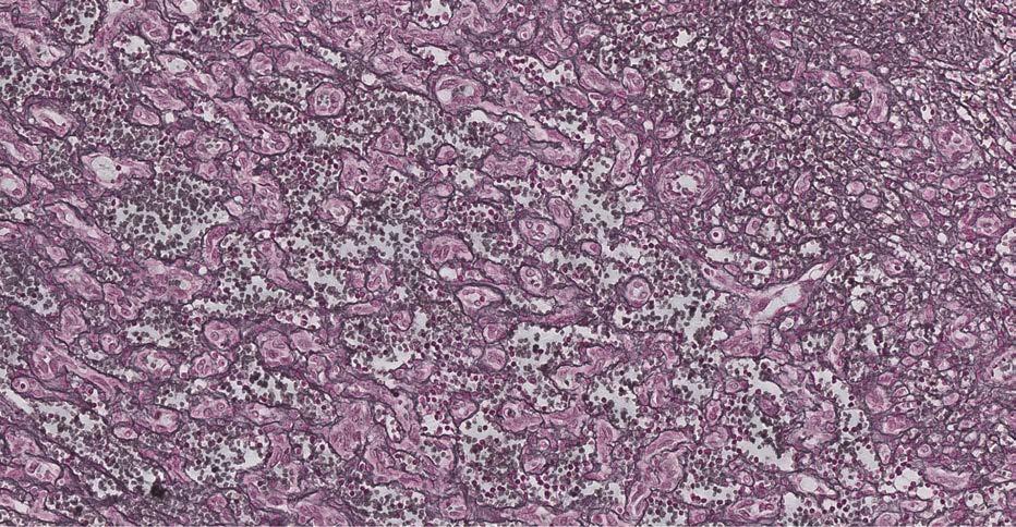 206 Obr. 3. Detail histologického preparátu: zvětšeno 200x, barvení H&E Fig. 3. Detail of histological specimen: 200x magnification, dying H&E Obr. 4.
