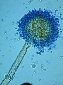 1 ROD ASPERGILLUS 1.1 OBECNÁ CHARAKTERISTIKA A TAXONOMIE Rod Aspergillus zahrnuje běžně se vyskytující saprofytické vláknité houby a spadá pod něj více než 250 druhů.