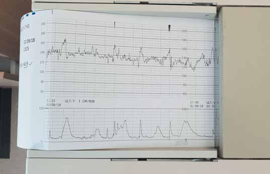 KLINICKÁ HODNOTA DIAGNOSTIKY nekultivačními technikami, jakož i přítomnost intraamniálního zánětu stanovením IL-6 v plodové vodě.