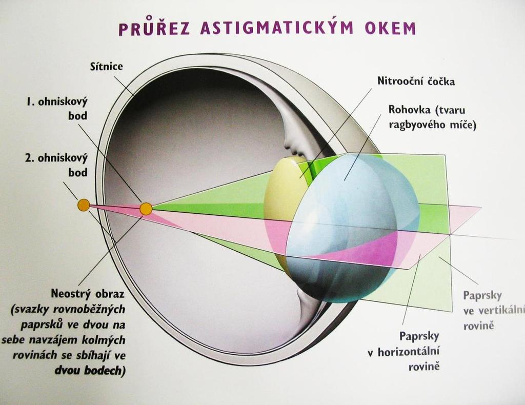 zakřivení, takže v každé z nich ovlivňuje sbíhavost