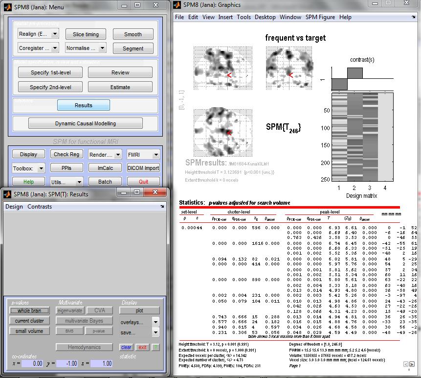 Obrázek : Grafické uživatelské rozhraní toolboxu SPM. Popis experimentu Data pocházela z vizuálního oddball experimentu []. Tento experiment obsahoval tři typy stimulů.