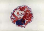 èujeme mezi základní parametry zavést i zhotovení trvalého cytologického preparátu, a to nejlépe alespoò ve dvou barveních: MGG (May-Grünwald a Giemsa-Romanowski) (Obr.