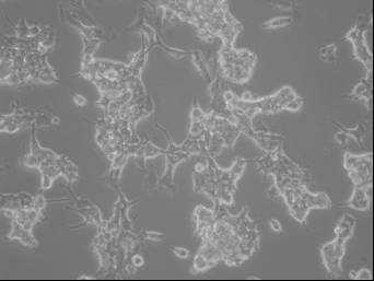 4 VÝSLEDKY 4.1 POKUSY IN VITRO 4.1.1 Pěstování buněčných linií Testy in vitro byly prováděny na buněčných liniích RC-4B/C a CHO-K1 s transfekovaným receptorem GPR10.