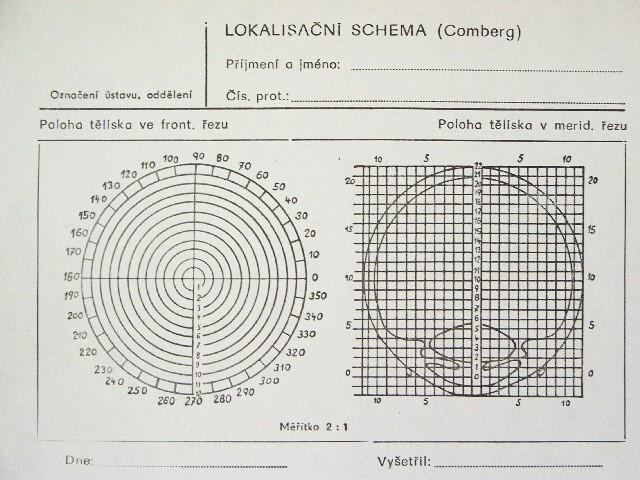 tzv. gonioskopická čočka. 4.2.7.1.