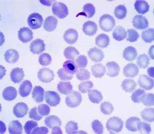 Obr. 21 Plasmodium