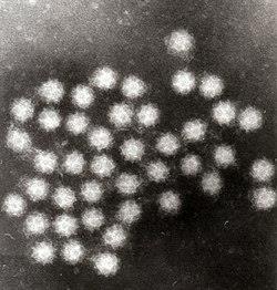 Viry původci alimentárních onemocnění Onemocnění Virus hepatitidy E způsobuje virovou hepatitidu (žloutenku) typu E. Jedná se o virové infekční onemocnění jater.
