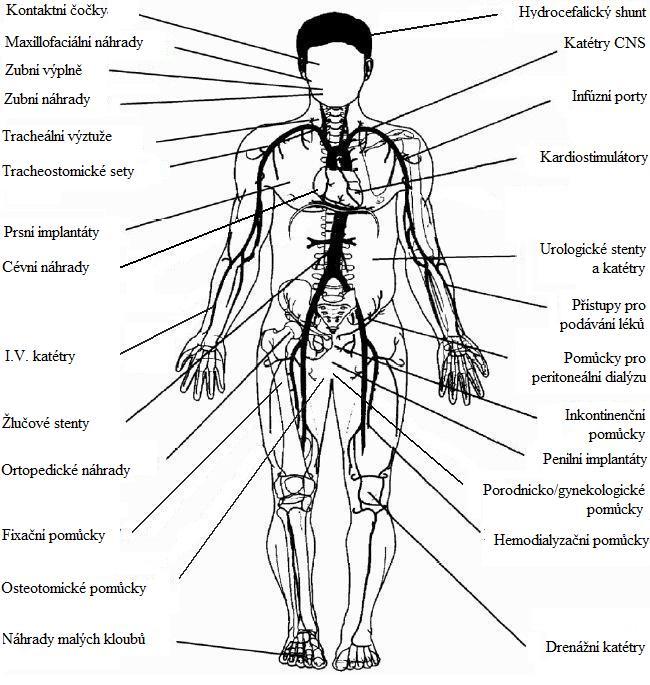 2 Biomateriály Biomateriál je syntetický materiál, který je používán k fyzikální náhradě tvrdé nebo měkké tkáně, která byla poškozena během patologického procesu (vlivem nemocí, úrazů) [9].