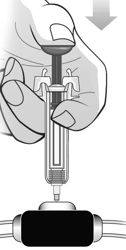 injekční stříkačku držíte ukazováčkem a prostředníčkem proti rukojeti dokud není všechen léčivý přípravek podán. Vytáhněte předplněnou injekční stříkačku ze žilního portu, ANIŽ byste uvolnili píst.