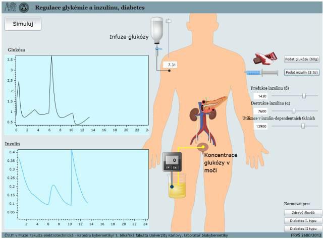 SADA VÝUKOVÝCH SIMULÁTORŮ - VÝSLEDKY VÝVOJE FRAMEWORKU BODYLIGHT Poruchy regulace glukózy Hladina glukózy nám ovlivňuje inzulín a naopak.