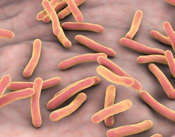 Brucelóza Bakterie Mycobacterium tuberculosis krav. Tomuto přenosu lze zabránit tepelným ošetřením mléka, jako je např. pasterace.