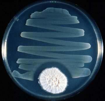 OBJEV versus VYNÁLEZ Objev: 1928, Alexander Fleming pozoroval, že kontaminace plísní zabíjí bakterie. Vynález: Izolovaná plíseň, způsoby její kultivace, izolované antibiotikum.
