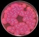 dk/atlas/microatlas/food/bacteria/bacillus_cereus/pop2.html http://www.eolabs.com/bacillus-cereus-pemba-pp0051.