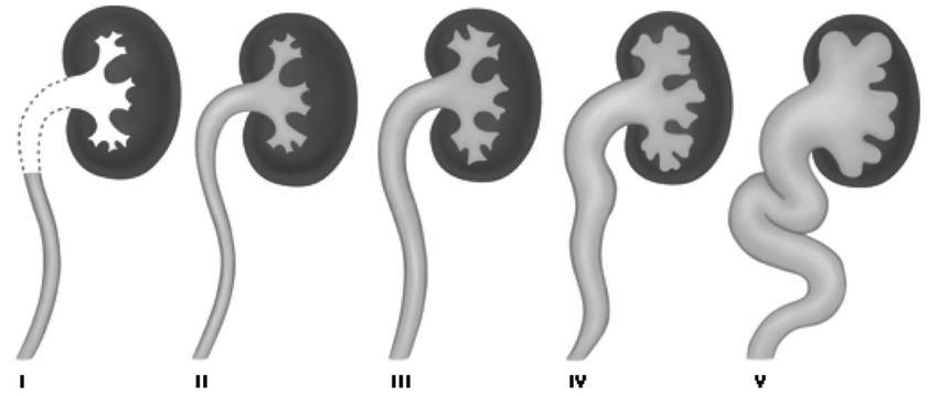 VUR International Reflux Study in Children, 1985