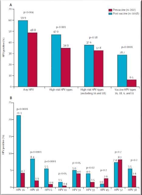 Austrálie plošná vakcinace dívek od 04/2007 12 13 let dívky doplňkové programy: 13 18 let dívky 18 26 let ženy 07/2007 do 2009 studie prevalence HPV typů u dívek v