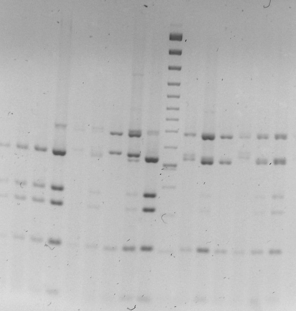 pod UV lampou pomocí ethidiumbromidu, který po navázání na DNA intenzivně fluoreskuje.