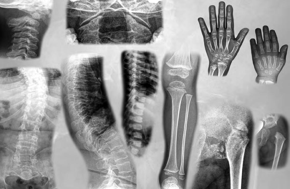 X-rays from archive of the Ambulant Centre for Defects of Locomotor Apparatus l.l.c. in Prague, Czech Republic.