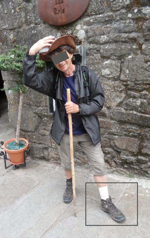 I recommended him to go out from the car on both feet, make exercises of the foot. He informed me through e-mail in August 2017: my left foot is not swollen, no pain, gait is normal.
