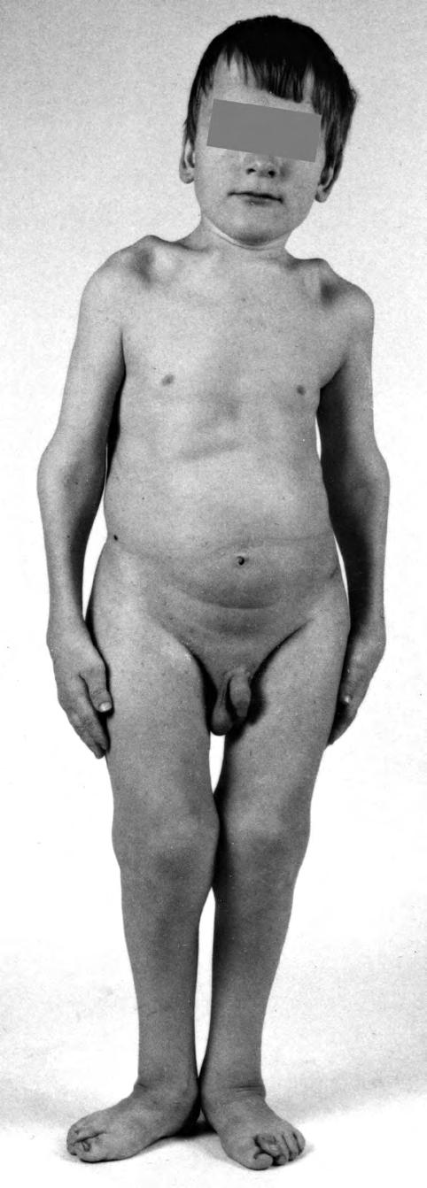 Fig. 1 A, B.