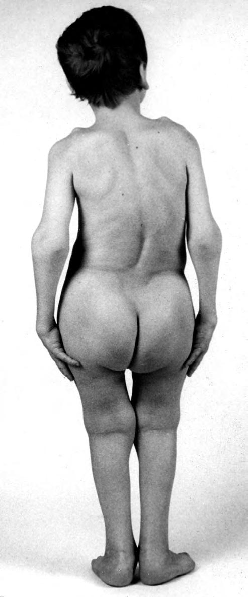 height 123 cm, weight 34 kg.