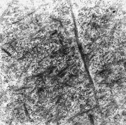 Cytoplasm contains big lipid droplets and numerous glycogen