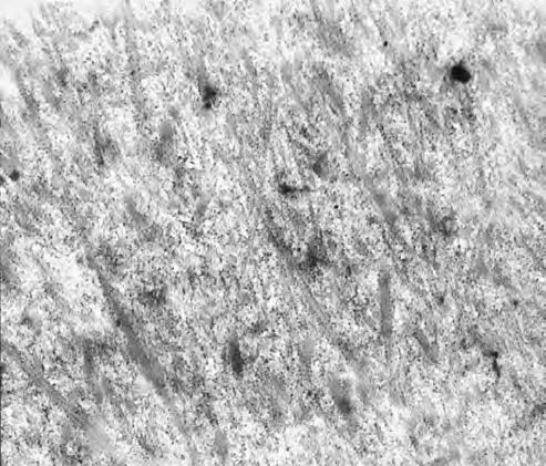 All examined cells remember regressively changed chondrocytes.