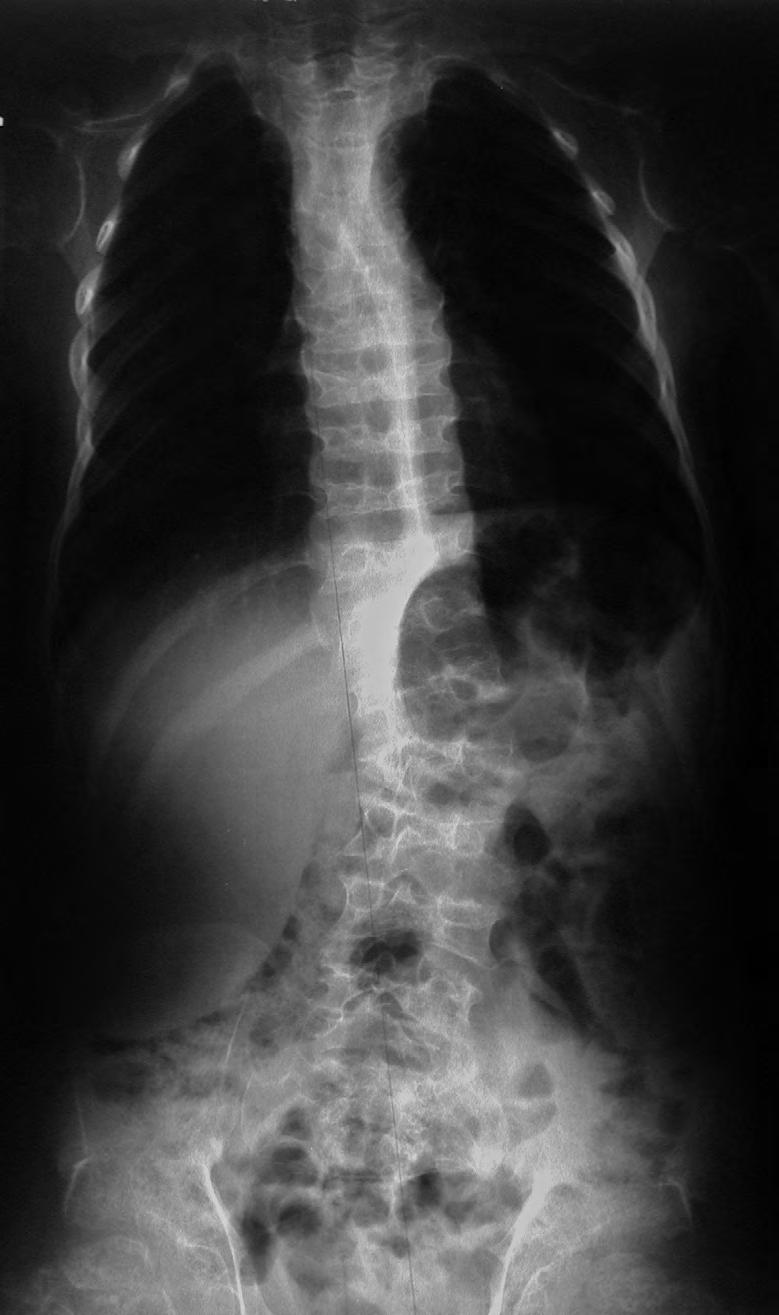 Fig. 5 D. MD variant.