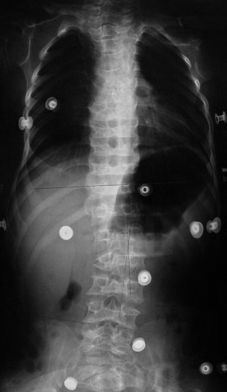 Fig. 5 E. MD variant.