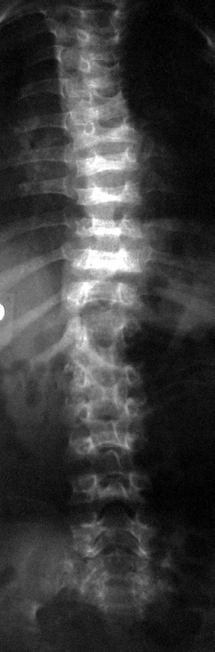 Fig. 7 A, B.