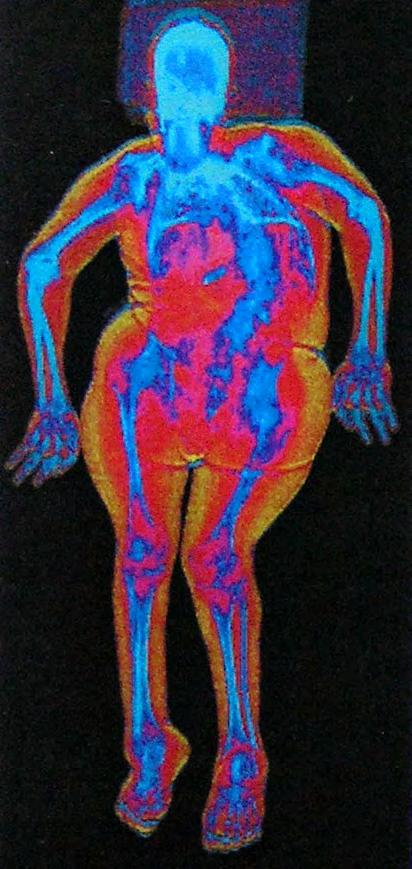 deformities and disproportionate stature of the