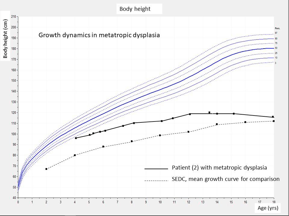 Fig. 9. Growth curve of patient No. 2 in comparison with Czech standards (Bláha et al. 2003) and spondyloepiphyseal dysplasia congenita (Horton et al. 1982). 3. BODEN SD, KAPLAN FS, FALLON MD et al.