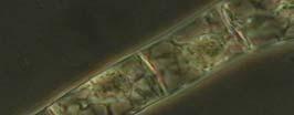 A kontrola SNP/ GGO B kontrola SNP/ GGO 10 µm 10 µm C Kontrola