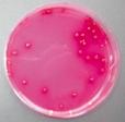 alespoà ve dvou ukazatelích: Pseudomonas aeruginosa a koliformní bakterie (za cca 340 Kã získáte orientaãní pfiehled o mikrobiologické kvalitû; vy etfiení provádí akreditované laboratofie jak pfii