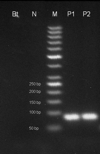 16/2014 s koncentrací DNA 5 ng/µl (16_14A), P2 pozitivní kontrola CRM 16/2014 s koncentrací DNA 10 ng/µl (16_14B). Amplifikační kit REDTaq. Obr.