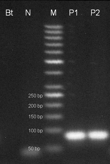 16/2014 s koncentrací DNA 5 ng/µl (16_14A), P2 pozitivní kontrola CRM 16/2014 s koncentrací DNA 10 ng/µl (16_14B). Amplifikační kit REDTaq. Obr.