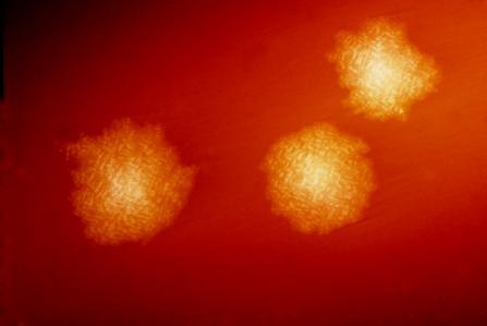 2 PŘEHLED LITERATURY 2.1 CLOSTRIDIUM DIFFICILE C. difficile je obligátně anaerobní sporulující bakterie tyčinkovitého tvaru, která byla poprvé izolována v roce 1935 ze stolice dítěte.
