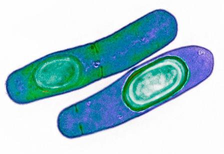 Díky používání selektivních médií obohacených o inhibitory růstu ostatní přítomné flóry, cefoxitin a cykloserin, byly tyto problémy již překonány (GEORGE et al. 1979).