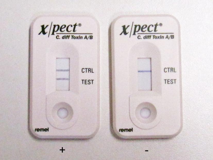 Obr. 14: Imunochromatografické testy detekující toxiny A a B (XPECT Clostridium difficile Toxin A/B Test, Oxoid).