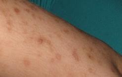 přípravků. Štěnice domácí je epidemiologicky významným členovcem, který má vliv na lidské zdraví.
