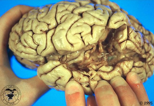 edu/courses/ling001/neurology.