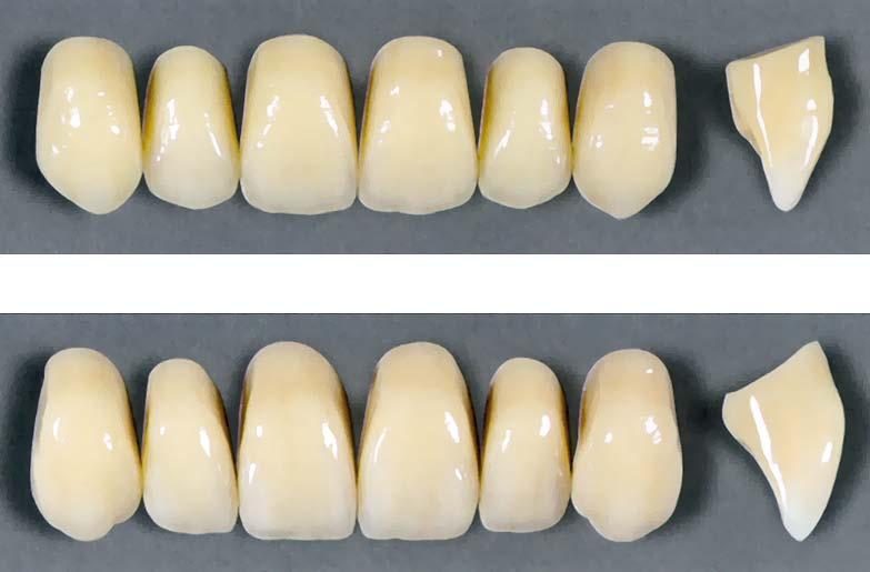 DENTÁLNÍ PRYSKYŘICE A ZUBY Frontální horní