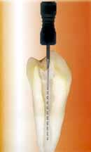 Hedström max. 450 800 Balení 6 ks, sortiment po 1 ks (cena za balení) ENDODONTICKÉ NÁSTROJE SYBRONENDO Reamer 4 mm Exstirpační jehla 4 mm Dřík Obj.