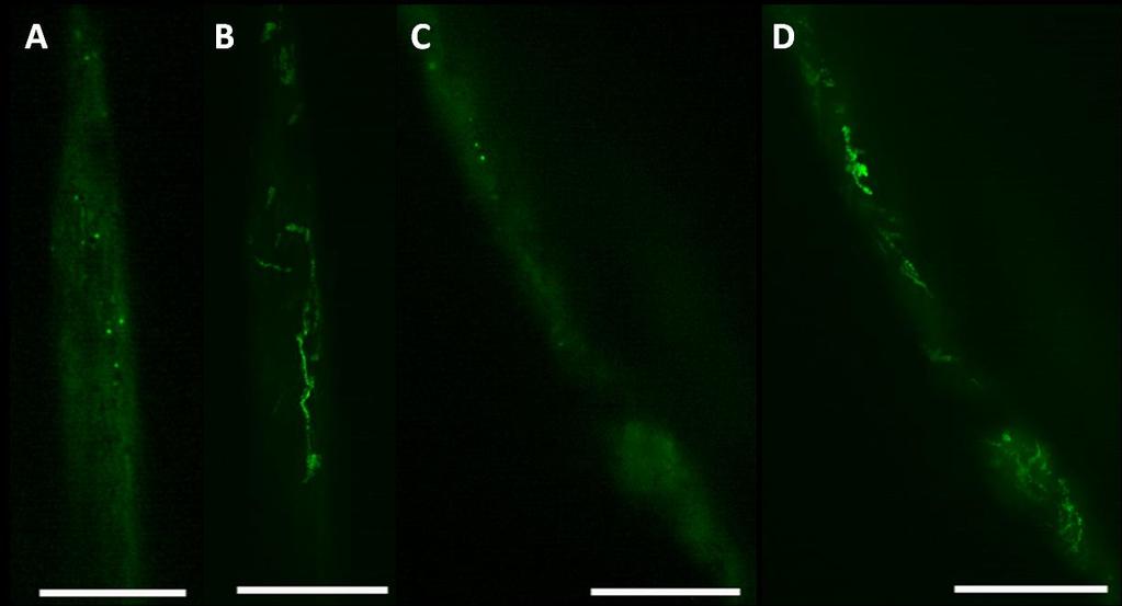 6.2.2 In vivo pozorování GFP-NtARPC2 rostlin TIRF mikroskopie TIRF mikroskopie potvrdila všechny doposud získané výsledky a umožnila sledovat velmi detailně pohyb teček, který lze chrakterizovat jako