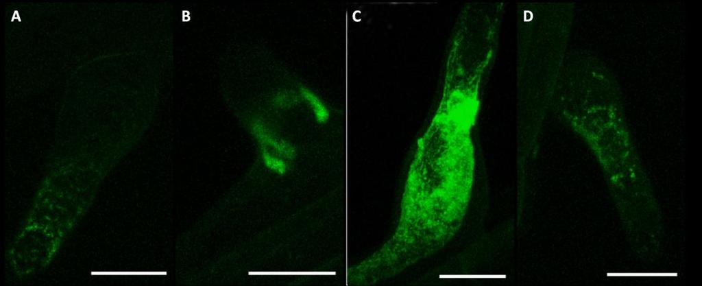 Obr. 15 Kořenové vlásky několikadenních rostlin Arabidopsis, stabilně transformovaných konstruktem GFP-NtArpC2 a indukovaných 2µM estradiolem, vždy maximální projekce 15 optických řezů: (A) indukce