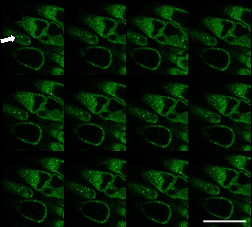 Obr. 16 Pokožka kořenového meristému několikadenních rostlin Arabidopsis, stabilně transformovaných konstruktem GFP-NtArpC2 a indukovaných 2µM estradiolem, časosběrná sekvence.