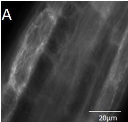Obr. 17 (A, B, C) Pokožka elongační zóny kořene několikadenních rostlin Arabidopsis, stabilně transformovaných konstruktem GFP-NtArpC2 a