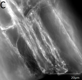 3 Imunofluorescence optimalizace protokolu Aby bylo možné studovat kolokalizaci pozorovaných teček s cytoskeletem, bylo rozhodnuto vizualizovat